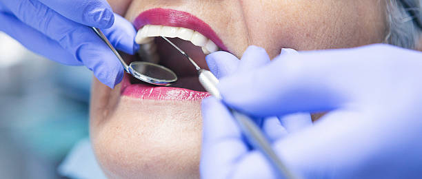 Best Emergency Tooth Extraction in Luther, OK